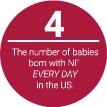 The number of babies born with NF in the United States Every Day is 4
